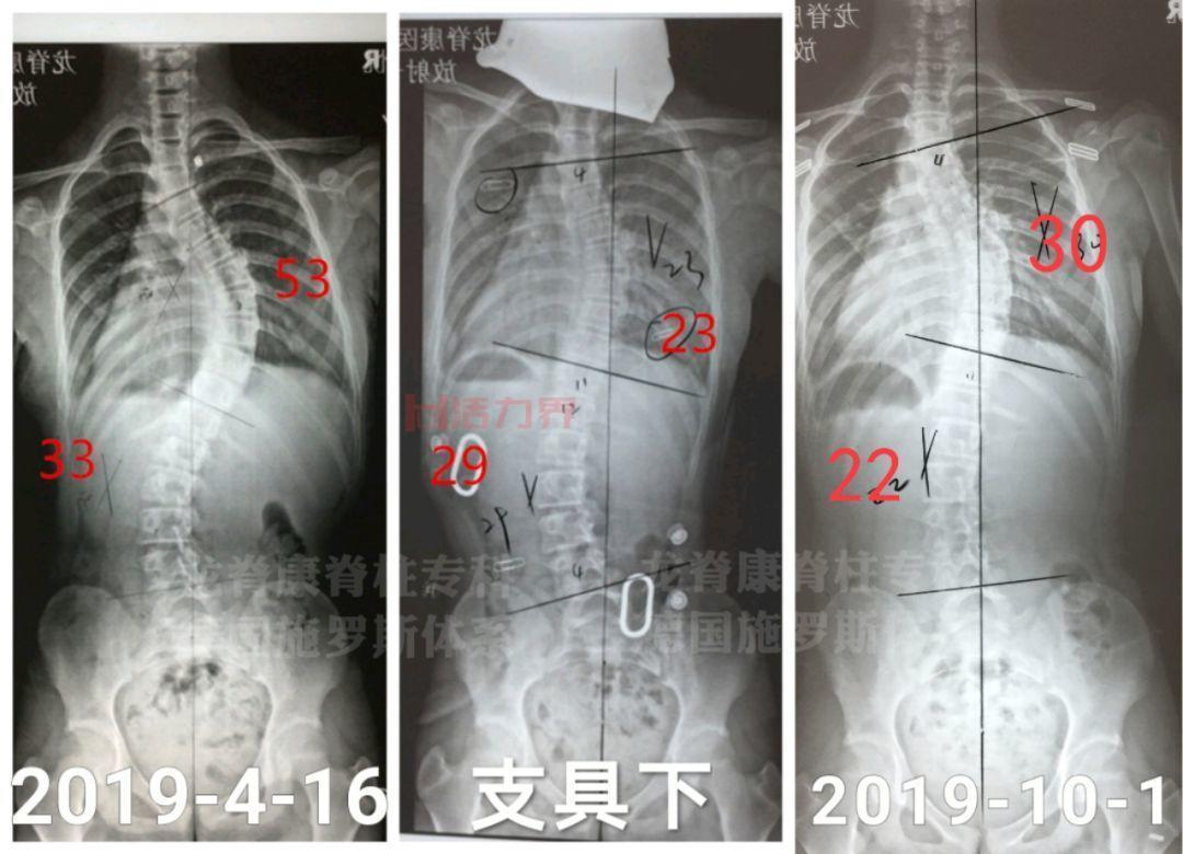 侧空翻要注意哪些问题？