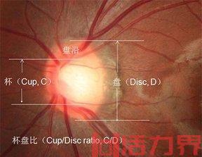 世界杯盘口解析：平半盘下盘近7成？